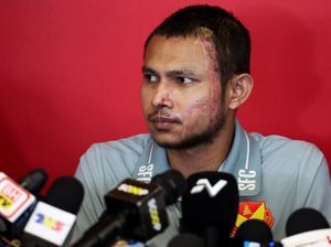 Foto: Penampakan Perdana Faisal Halim Usai Disiram Air Keras Foto: Penampakan Perdana Faisal Halim Usai Disiram Air Keras