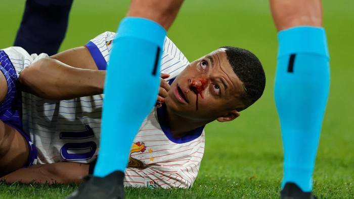 DUSSELDORF, GERMANY - JUNE 17: Kylian Mbappe of France Injured his head during the  EURO match between Austria  v France at the Merkur Spiel Arena on June 17, 2024 in Dusseldorf Germany (Photo by Rico Brouwer/Soccrates/Getty Images)