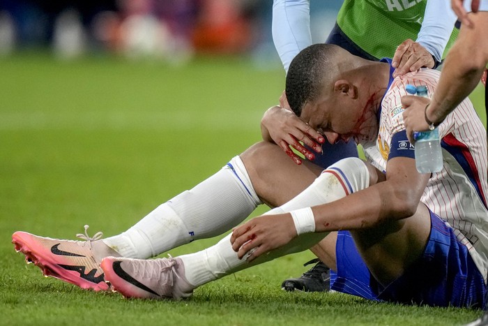 Kylian Mbappe of France receives a treatment after suffering an injury during a Group D match between Austria and France at the Euro 2024 soccer tournament in Duesseldorf, Germany, Monday, June 17, 2024. (AP Photo/Alessandra Tarantino)