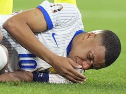 Euro 2024: Mbappe Diragukan Tampil Melawan Belanda