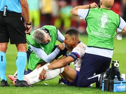 Deschamps Tak Bisa Pastikan Apakah Mbappe Bisa Bermain Lagi di Euro 2024