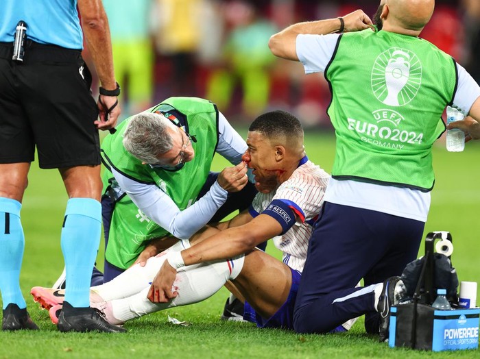 DUSSELDORF, GERMANY - JUNE 17: Kylian Mbappe of France goes down with a nose bleed during the UEFA EURO 2024 group stage match between Austria and France at D¸sseldorf Arena on June 17, 2024 in Dusseldorf, Germany.(Photo by Charlotte Wilson/Offside/Offside via Getty Images)