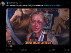 Begini situasi Mbappe saat diwawancara usai laga, babak belur. (Foto: Twitter @dnctway)