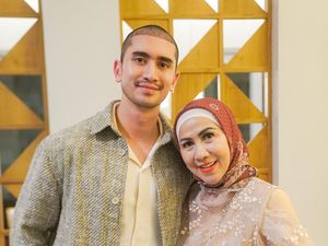 Verrell Bramasta Rayakan Idul Adha dengan Rambut Baru Usai Transplantasi di Turki