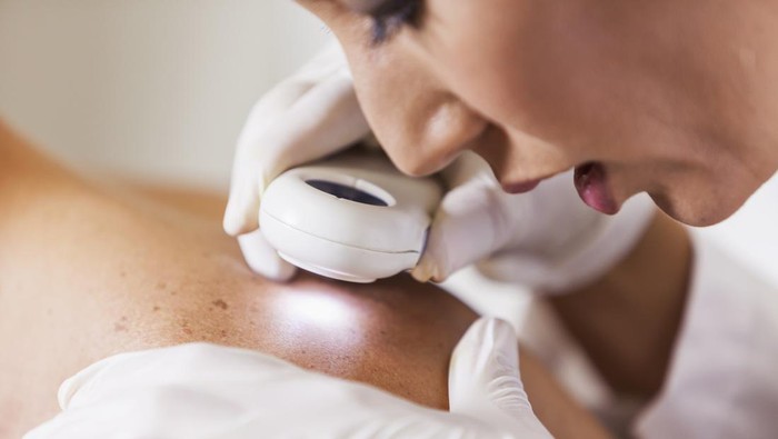Female dermatologist (30s) examining male patients skin with dermascope, carefully looking at a mole for signs of skin cancer.