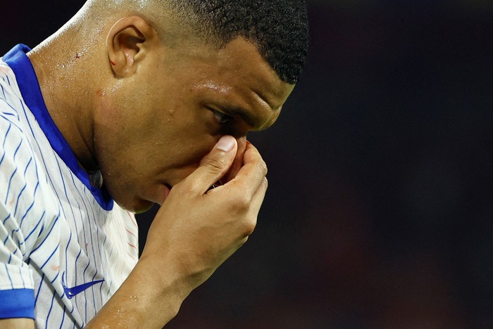 Soccer Football - Euro 2024 - Group D - Austria v France - Dusseldorf Arena, Dusseldorf, Germany - June 17, 2024 Frances Kylian Mbappe holds his face after sustaining a facial injury REUTERS/Thilo Schmuelgen     TPX IMAGES OF THE DAY