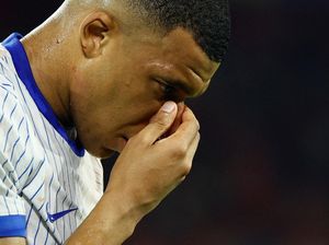 Mbappe akan Absen Akibat Cidera Patah Hidung, Prancis Optimis dengan Skuadnya Mbappe akan Absen Akibat Cidera Patah Hidung, Prancis Optimis dengan Skuadnya