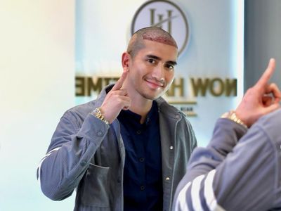 Foto Verrel Bramasta Kini Botak Demi Tanam Rambut, Kompak Bareng Adik & Ayah
