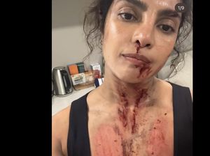 Priyanka Chopra Penuh Darah dan Luka