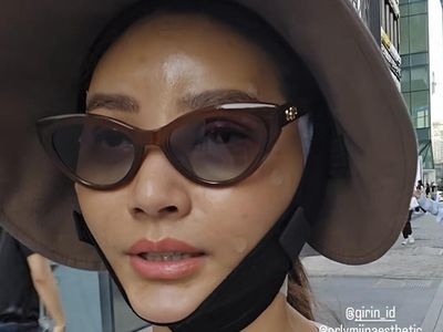 6 Potret Sarwendah Setelah Oplas di Korea, Jalan-jalan Dengan Wajah Diperban