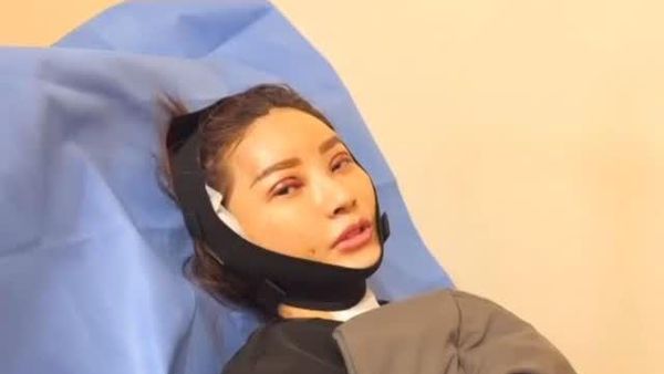 Potret Wajah Sarwendah Masih Bengkak Usai Operasi Plastik di Korea