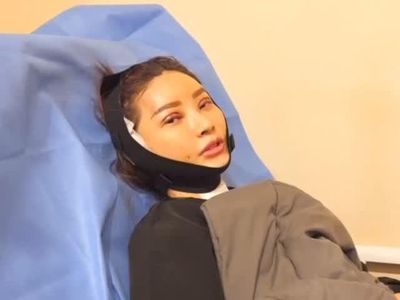 Potret Wajah Sarwendah Masih Bengkak Usai Operasi Plastik di Korea