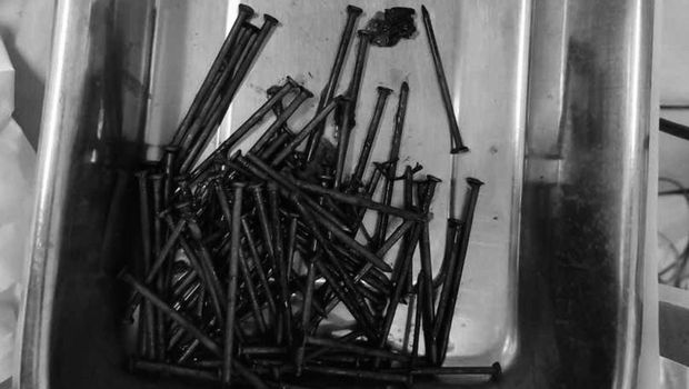 Sebuah paku menancap di tubuh muda Indramayu