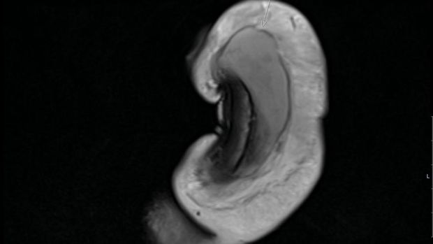 Penis patah Penis patah