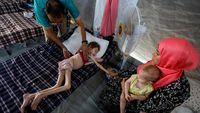 Potret Pilu Anak-anak di Gaza Menderita Malnutrisi