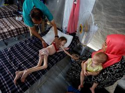 Jangan Lupakan Gaza! Banyak Anak Mati Kelaparan karena Agresi Israel