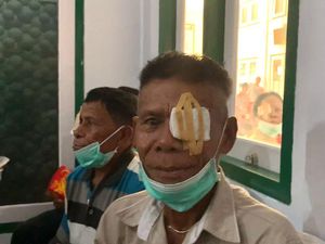 Bahagianya Yohanis dan Markus Usai Operasi Katarak Gratis dari Kemensos