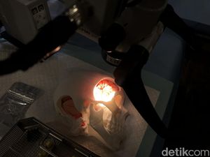Bisa Mengancam Jiwa, Kenali Gejala Pecah Pembuluh Darah Otak saat Bangun Tidur Bisa Mengancam Jiwa, Kenali Gejala Pecah Pembuluh Darah Otak saat Bangun Tidur