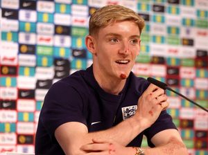 Anthony Gordon Jatuh dari Sepeda, Bonyok Jelang Inggris Vs Slovakia Anthony Gordon Jatuh dari Sepeda, Bonyok Jelang Inggris Vs Slovakia