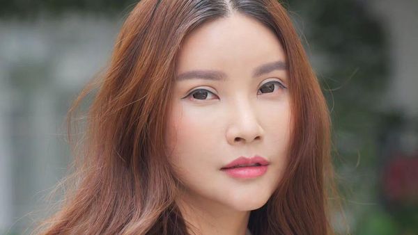 Foto: 7 Artis Indonesia Setelah Operasi Hidung karena Bengkok dan Sinusitis