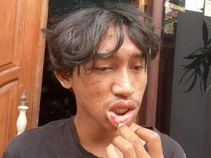 Pemuda Asal Kota Malang Dipukuli 5 Orang gegara Teriakan