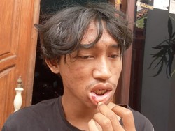 Pemuda Asal Kota Malang Dipukuli 5 Orang gegara Teriakan