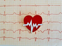 Kapan Perlu Pasang Ring Jantung? Ini Kata Dokter Kardiologi