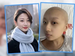 Wanita Kirim Foto Palsu Editan AI Dirinya Untuk Sang Nenek, Alasannya Sedih