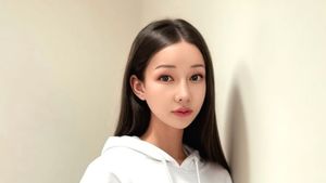 Foto Terbaru Lucinta Luna Setelah Berkali-kali Oplas & Diet, Jadi Bak Barbie