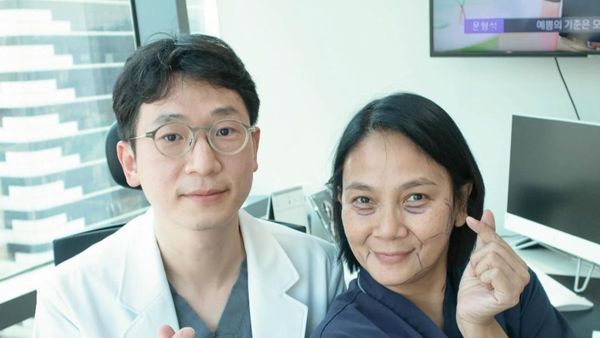 7 Potret Dian Nitami Oplas di Korea, Pulang ke RI Dengan Wajah Masih Bengkak