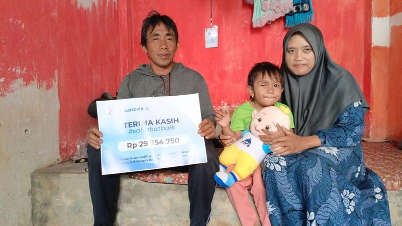 Sahabat Baik Bantu Hani Beli Bola Mata Palsu hingga Berkurban