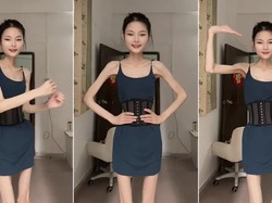 Bak Tengkorak Hidup, Wanita Berbobot 25 Kg Ini Masih Ingin Turun BB