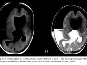 Foto Fenomena Fetus in Fetu, Ketika Hidup dengan Janin Parasit di Tubuhnya Foto Fenomena Fetus in Fetu, Ketika Hidup dengan Janin Parasit di Tubuhnya
