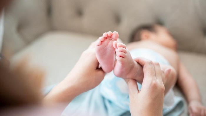 Ilustrasi Hidrokel pada Bayi Ilustrasi Hidrokel pada Bayi