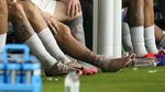 Foto: Engkel Bengkak Lionel Messi