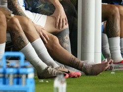 Sebagai salah satu perawatan pertama, engkel La Pulga dikompres. Foto: AP/Julio Cortez