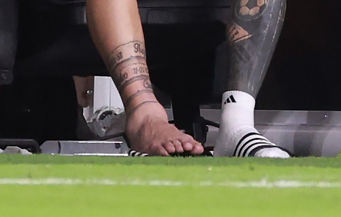 MIAMI GARDENS, FLORIDA - JULY 14: Lionel Messi of Argentina watches the actions from the bench after leaving the pitch with an injury during the CONMEBOL Copa America 2024 Final match between Argentina and Colombia at Hard Rock Stadium on July 14, 2024 in Miami Gardens, Florida. (Photo by Carmen Mandato/Getty Images)