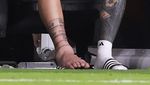 Foto: Engkel Bengkak Lionel Messi