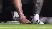 Saat di-zoom, beginilah kondisi engkel yang bengkak di kaki kanan Messi. Foto: Getty Images/Carmen Mandato