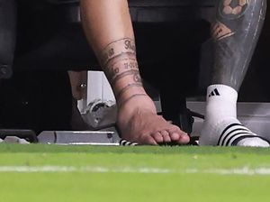 Foto: Engkel Bengkak Lionel Messi