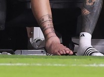 Foto: Engkel Bengkak Lionel Messi