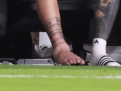 Saat di-zoom, beginilah kondisi engkel yang bengkak di kaki kanan Messi. Foto: Getty Images/Carmen Mandato