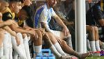 Foto: Engkel Bengkak Lionel Messi