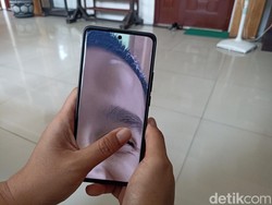 Anak Polisi di Blitar Jadi Korban Penganiayaan