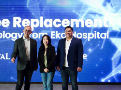 Ganti Lutut dengan Teknologi Robotik, Lini Inovasi Baru dari Eka Hospital
