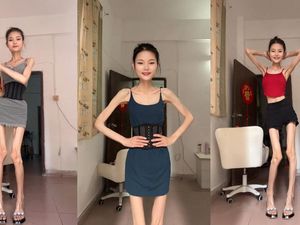 Berat Wanita Ini Setara Sekarung Beras Berat Wanita Ini Setara Sekarung Beras