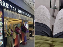 Apes! Wanita Ini Tersiram Kuah Sup Panas Saat Makan di Restoran