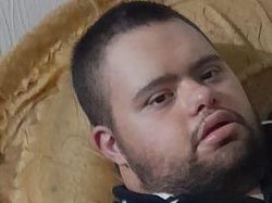 Pilu Pria Down Syndrome Diserang Anjing Militer Israel-Meninggal