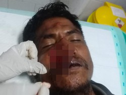 Pria di Sumba Barat Babak Belur Dihajar Kades Saat Hendak Lerai Pertengkaran