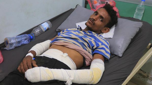 Kondisi Korban Luka Akibat Serangan Israel di Pelabuhan Yaman